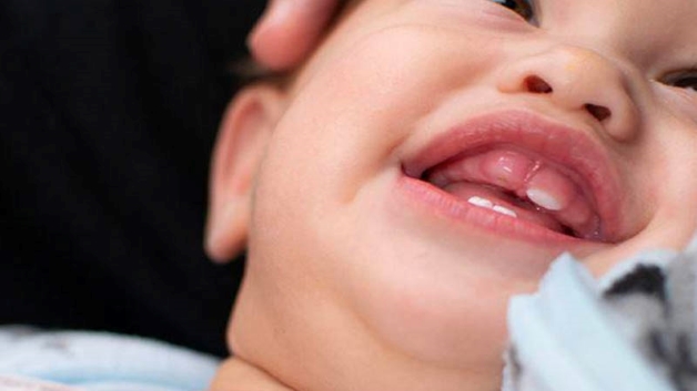 vì sao trẻ mọc răng nanh trước