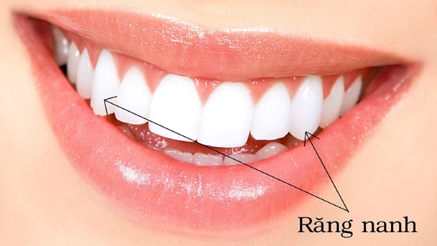 vì sao trẻ mọc răng nanh trước