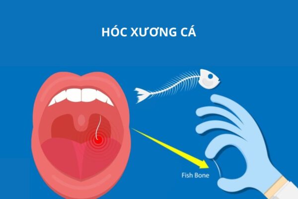 4. Khi Nào Cần Đến Bác Sĩ?