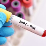 Ý nghĩa của phương pháp xét nghiệm sàng lọc trước sinh NIPT