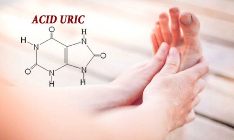 Acid uric 4