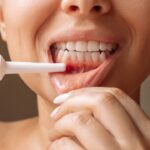 5 Loại thuốc chữa nhiệt miệng bạn nhất định phải biết