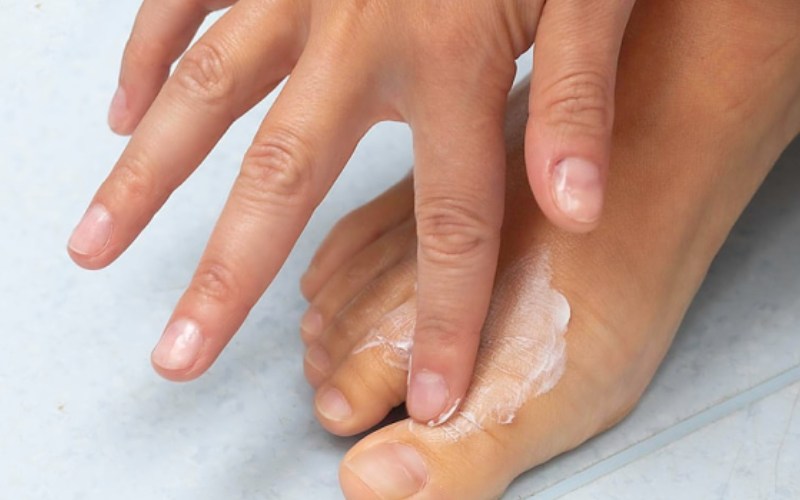 thuốc điều trị nấm kẽ chân mua ở đâu