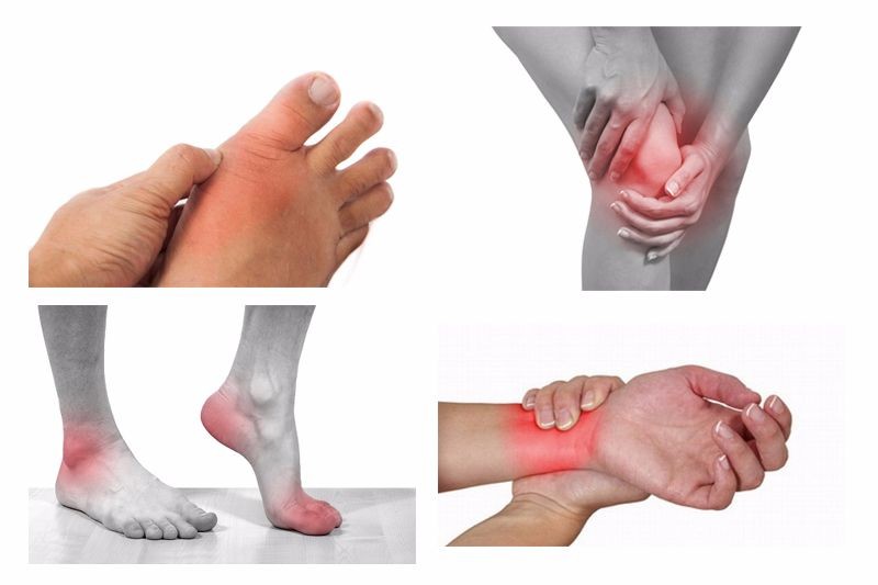 Meloxicam là thuốc giảm đau và chống viêm được dùng để điều trị viêm khớp dạng thấp, viêm cột sống dính khớp, viêm khớp các vị trí.