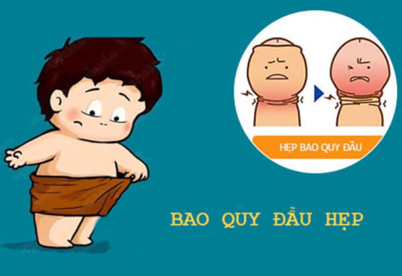 bieu hien hep bao quy dau