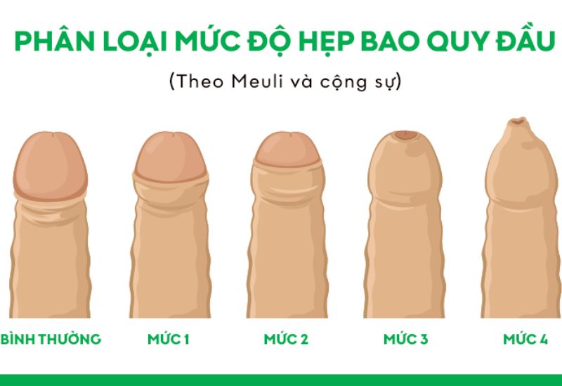 cac muc do hep bao quy dau