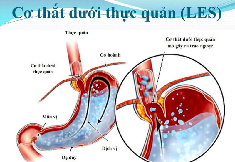 trao nguoc axit da day thuc quan do