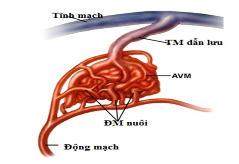 minh hoa di dang dong tinh mach nao