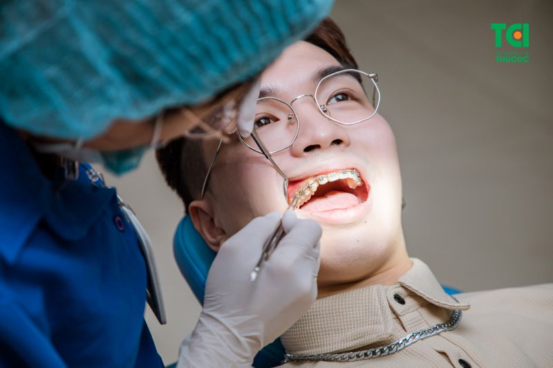 Niềng răng không chỉ giúp bạn có một nụ cười đẹp, mà còn mang lại những lợi ích về sức khỏe răng miệng.