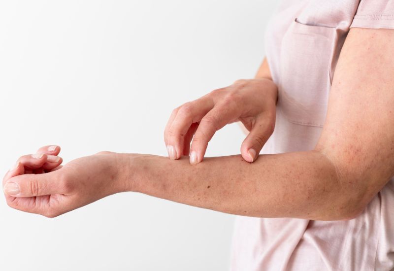 Trong Đông y, rau má thường được dùng để chữa các bệnh liên quan đến nhiệt như rôm sảy nhờ đặc tính thanh nhiệt và kháng viêm tự nhiên.