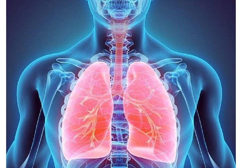 Chẩn đoán căn bệnh viêm phổi