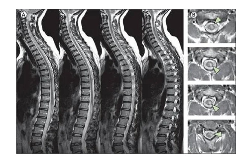 So sánh các phương pháp chẩn đoán hình ảnh cột sống