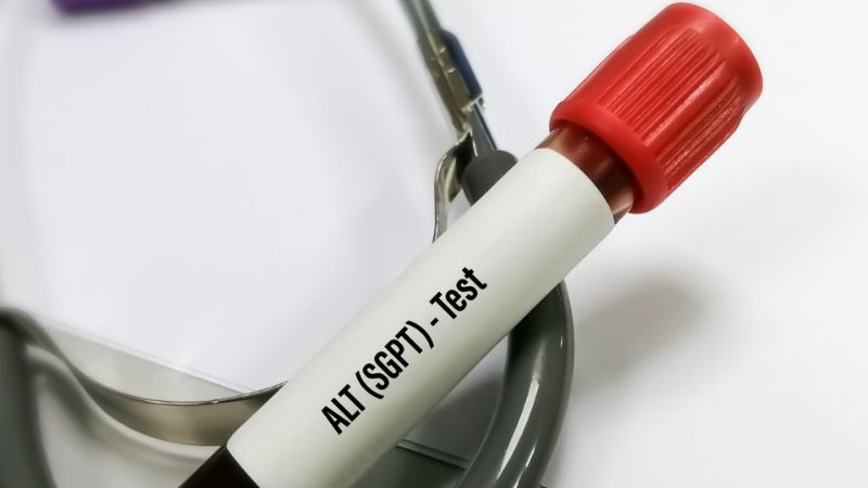 Đặc điểm của men gan cao và gan nhiễm mỡ