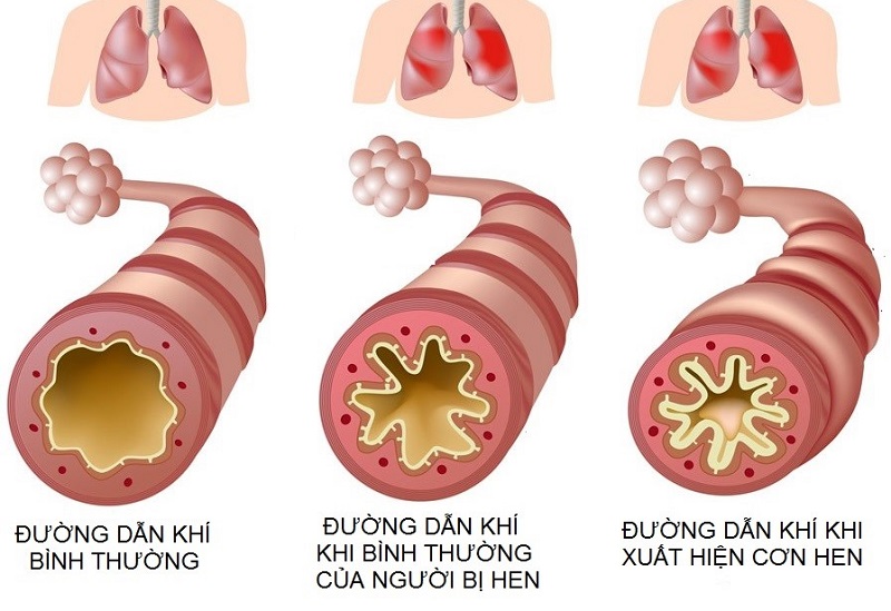 tìm hiểu nguyên nhân bị tai fun88