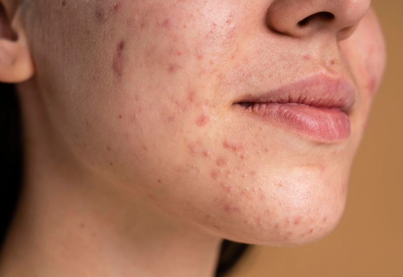 Giải đáp chi tiết thắc mắc: Thừa vitamin b12 gây bệnh gì?