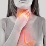 Trào ngược dạ dày gây ho kéo dài: chớ coi thường