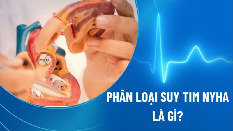 Phân loại suy fun88 fun88vi.info theo phân độ NYHA và những triệu chứng tương ứng