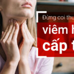 Viêm họng cấp tính cũng có thể nguy hiểm – chớ coi thường
