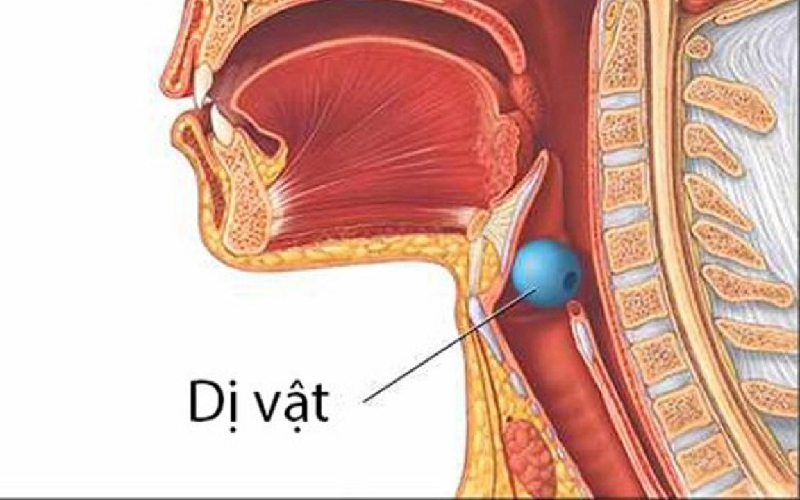 Nhận biết và Xử trí fun88 linkbong88moinhat thở