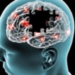 Bệnh Alzheimer nguyên nhân do đâu và dấu hiệu nhận diện sớm