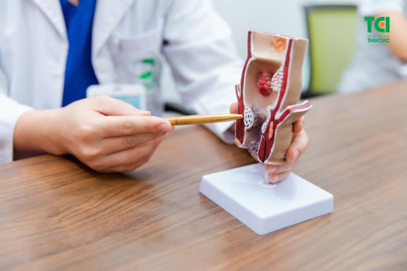 Chảy máu do trĩ có thể gây ra ảnh hưởng tiêu cực đến sức khỏe (Ảnh: TCI)