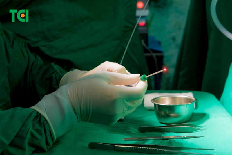 Đốt trĩ xâm lấn tối thiểu nên hầu như không gây đau hoặc đau rất ít – nhanh hồi phục (Ảnh: TCI)