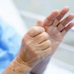 Bệnh Parkinson biểu hiện như thế nào và cách chẩn đoán, điều trị