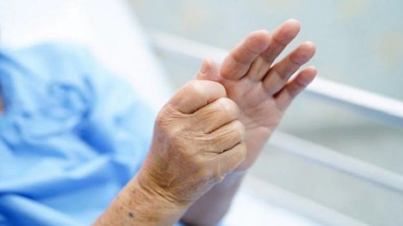 Parkinson là gì và biểu hiện như thế nào?