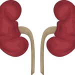 5 Biến chứng nếu không điều trị sỏi đường tiết niệu kịp thời