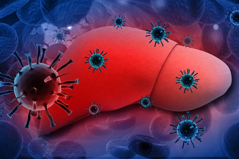Nhiễm virus viêm gan B