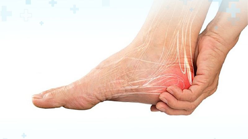 Đau khớp gót chân biểu hiện như thế nào?