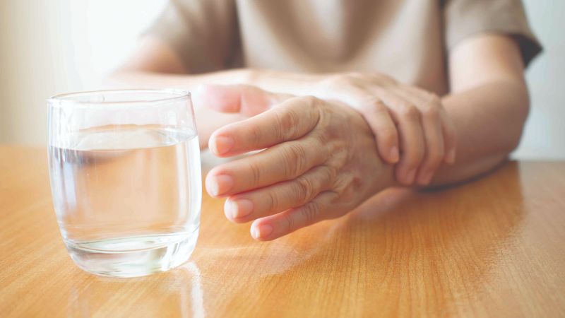 Điều trị Parkison bằng phương pháp nào?