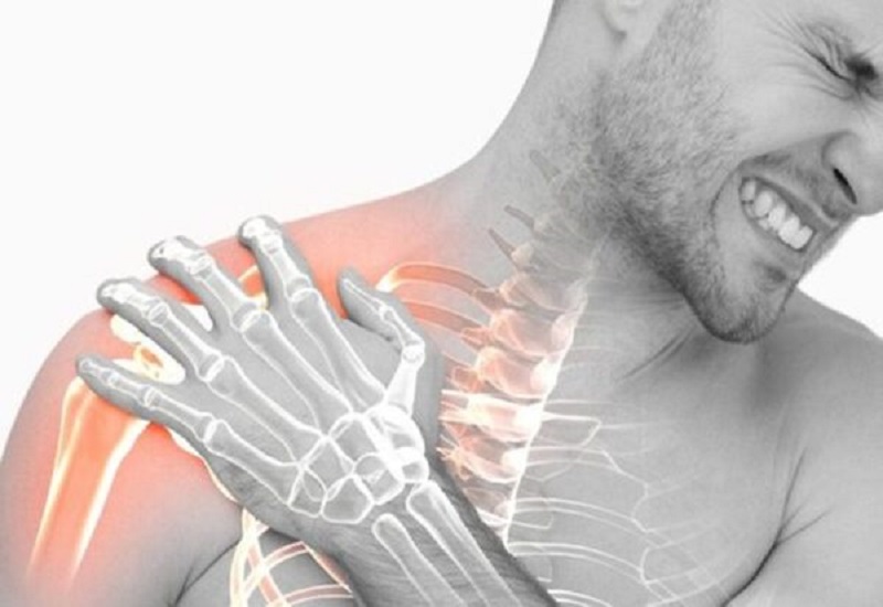 Người bệnh cảm thấy đau nhói dữ dội ở vùng vai ngay sau khi bị chấn thương