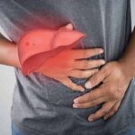 Cách điều trị xơ gan phù hợp với từng đối tượng