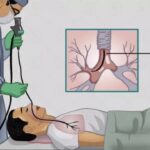 8 Phương pháp chẩn đoán bệnh giãn phế quản hiệu quả