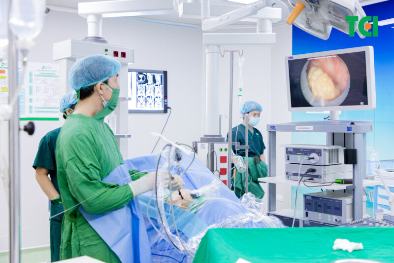 Những cách điều trị sỏi tiết niệu hiện đại