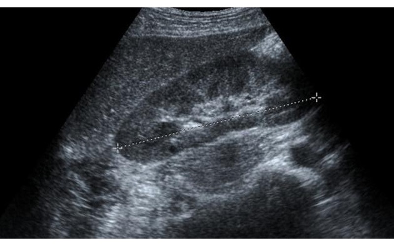 Siêu âm là phương pháp phổ biến đầu tiên ược sử dụng nhờ tính an toàn, không xâm lấn và dễ thực hiện.