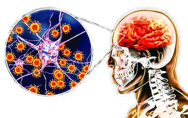Viêm não Nhật Bản là một căn bệnh nguy hiểm do virus gây ra, chủ yếu lây truyền qua muỗi đốt.
