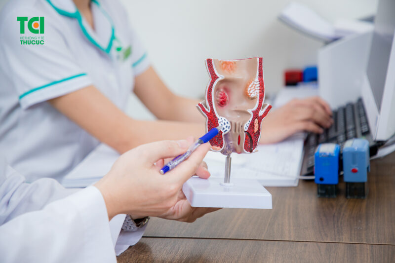 Trĩ nội có đau không - Câu trả lời phụ thuộc vào từng giai đoạn