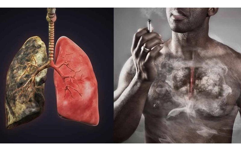 Hút thuốc làm tăng nguy cơ mắc nhiều loại ung thư, trong đó có ung thư gan