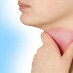 Basedow là bệnh gì – Cảnh báo căn bệnh cường giáp tự miễn nguy hiểm