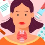 Cách nhận biết người bị cường giáp và cách điều trị