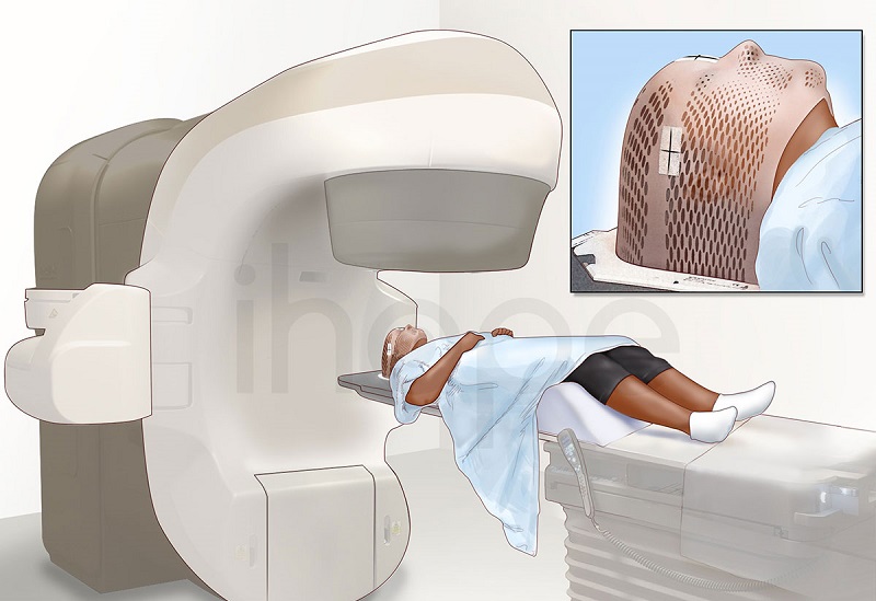Cách điều trị bệnh ung thư máu