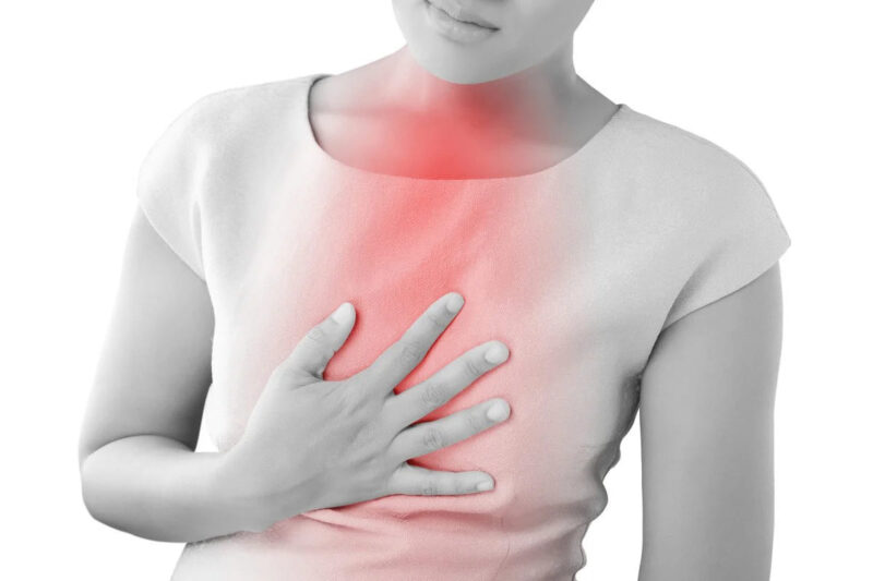Bệnh lý về thực quản, dạ dày thường là nguyên nhân phổ biến gây đau rát ở ngực.