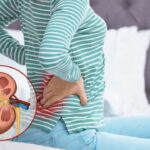Giãn đài bể thận ở người lớn do sỏi niệu quản và cách khắc phục
