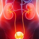 Hậu quả của giãn đài bể thận – Những biến chứng cần biết