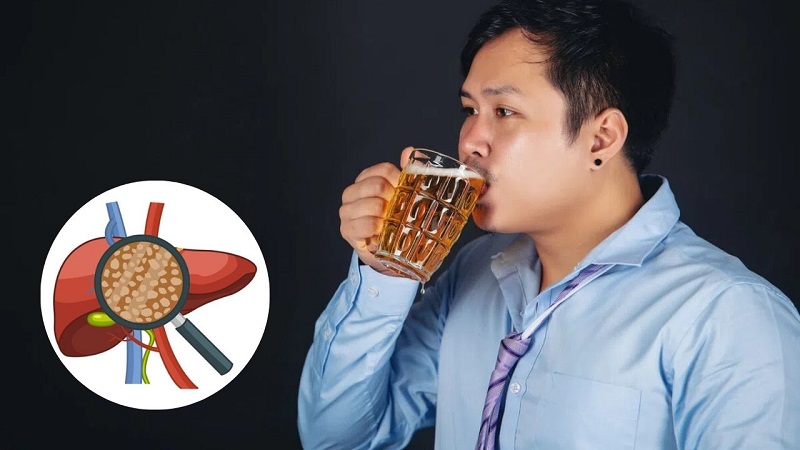 Nguyên nhân xơ gan thường gặp là gì?