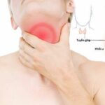 Nhận biết 8 dấu hiệu của bệnh ung thư tuyến giáp giai đoạn cuối