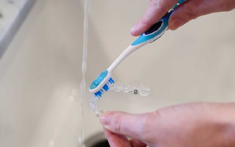 Niềng răng không mắc cài có tốt không