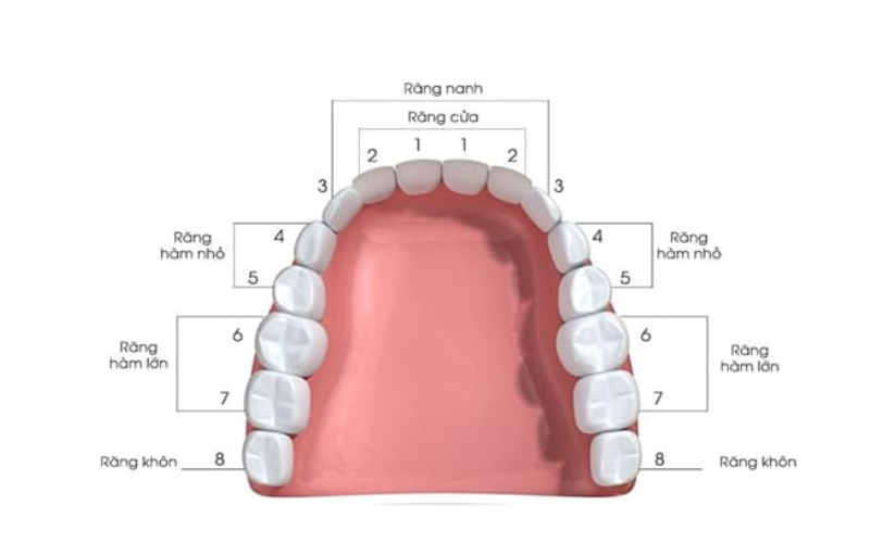 răng khôn mọc lệch có nên nhổ không bác sĩ